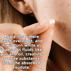 Pimple Patches